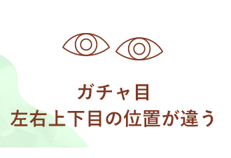 ガチャ目左右上下目の位置が違う